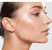 Harmonização Facial